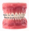 Iconix-BracketComp.jpg